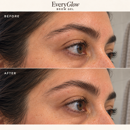 EveryGlow - Brow lift